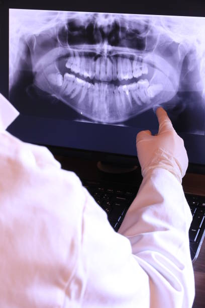 Best Emergency Dental Care for Broken or Chipped Teeth in Windsor, PA
